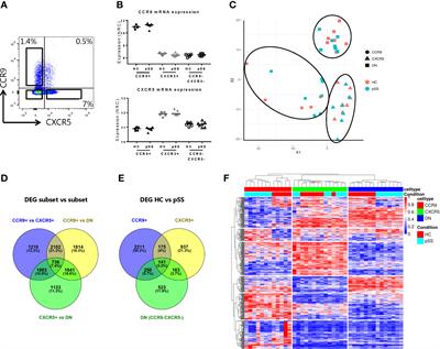 Transcriptome Analysis of CCR9+ T Helper Cells From Primary Sjögren’s Syndrome Patients Identifies CCL5 as a Novel Effector Molecule